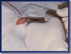 circ6