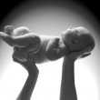 Circumcision